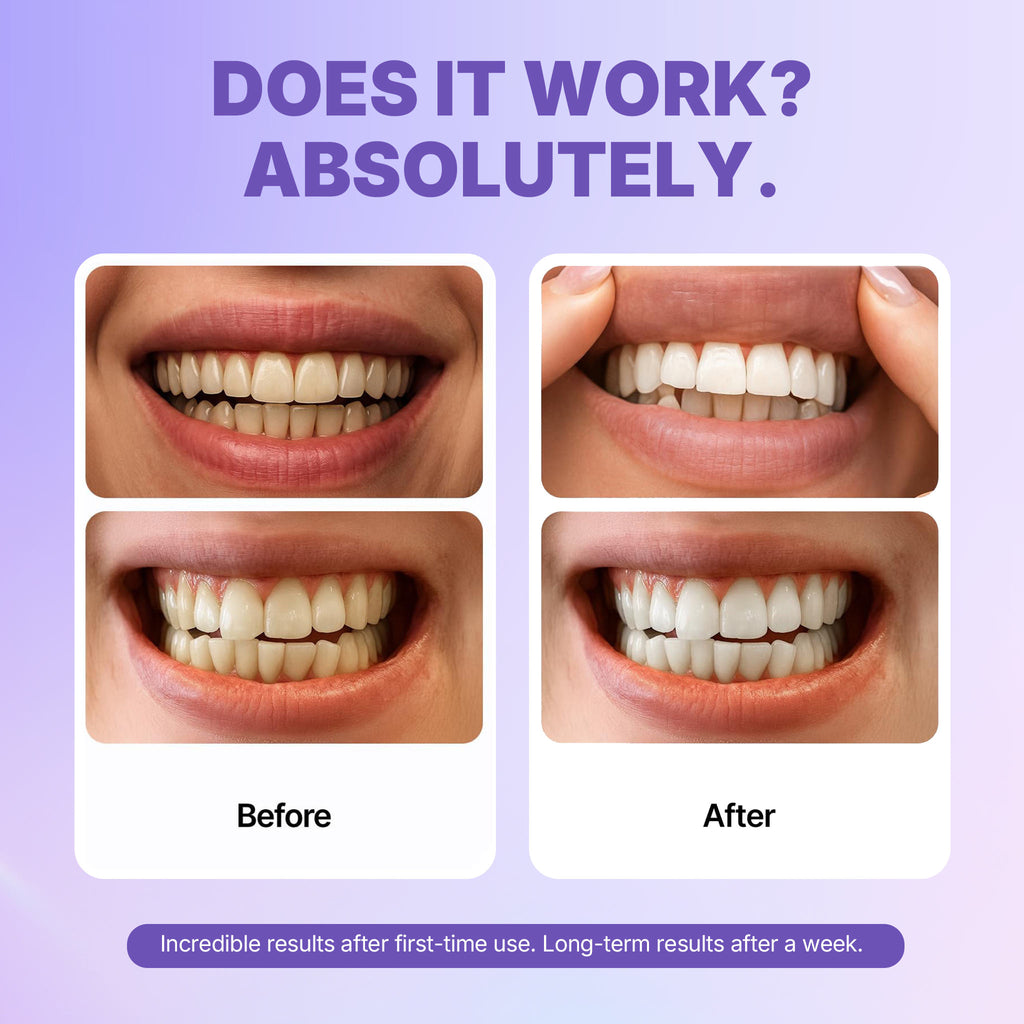 Dr. Dent Purple Teeth Whitening Enamel-Care Cleaning Strips